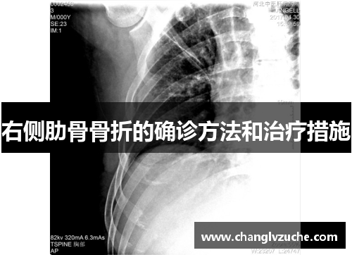 右侧肋骨骨折的确诊方法和治疗措施